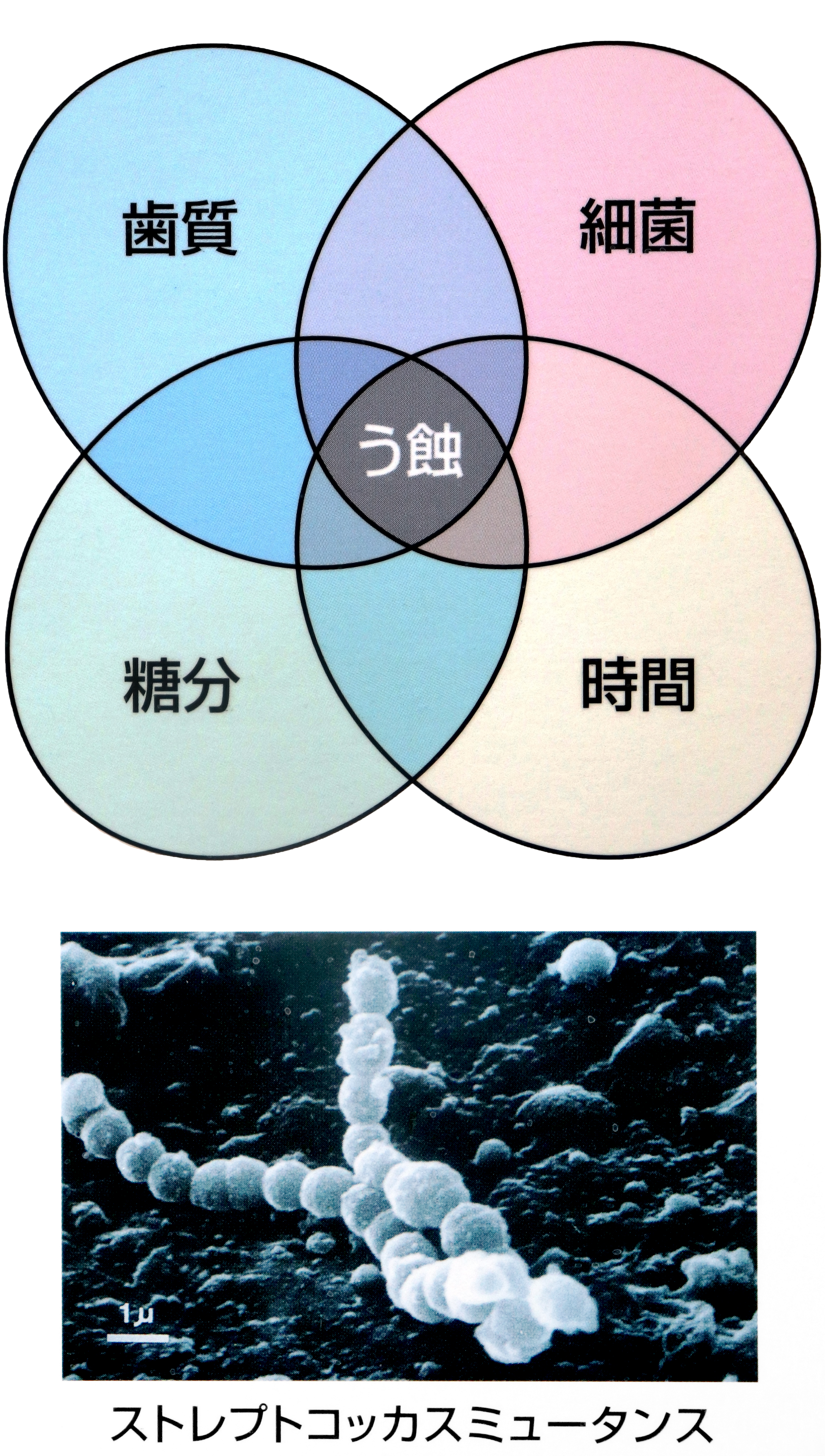 32：カリエスの原因0132修正.jpg