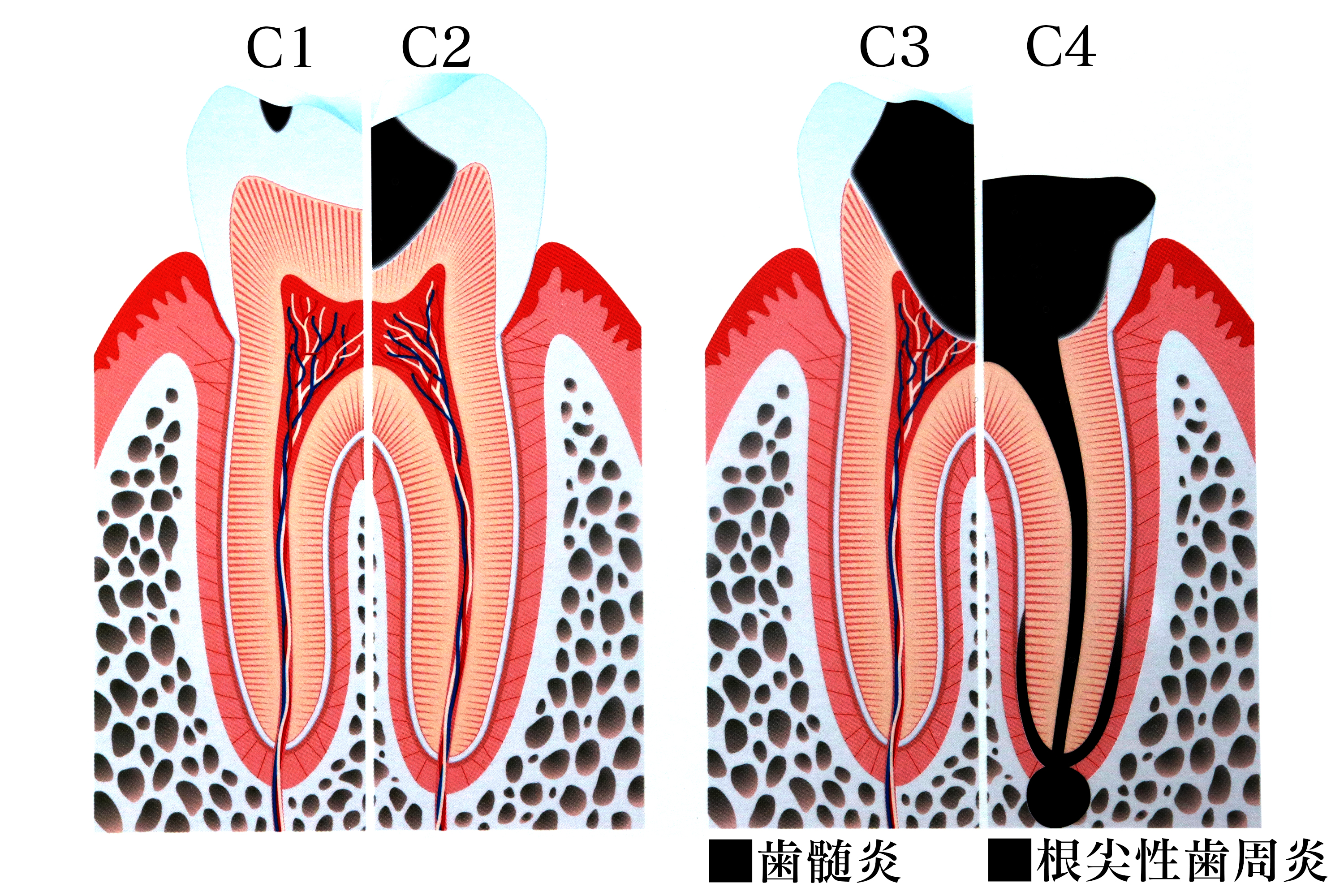33：C1~C4：0130修正.jpg